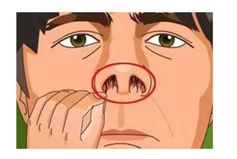 分支代號是什麼 鼻毛外露原因
